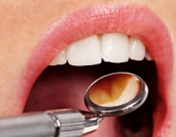 Dentisterie générale