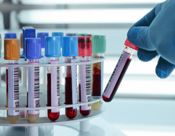 Autres services professionnels – Services diagnostiques